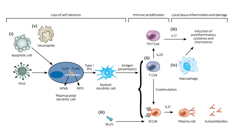 Systemic lupus erythematosus: an update | The Medical Journal of Australia