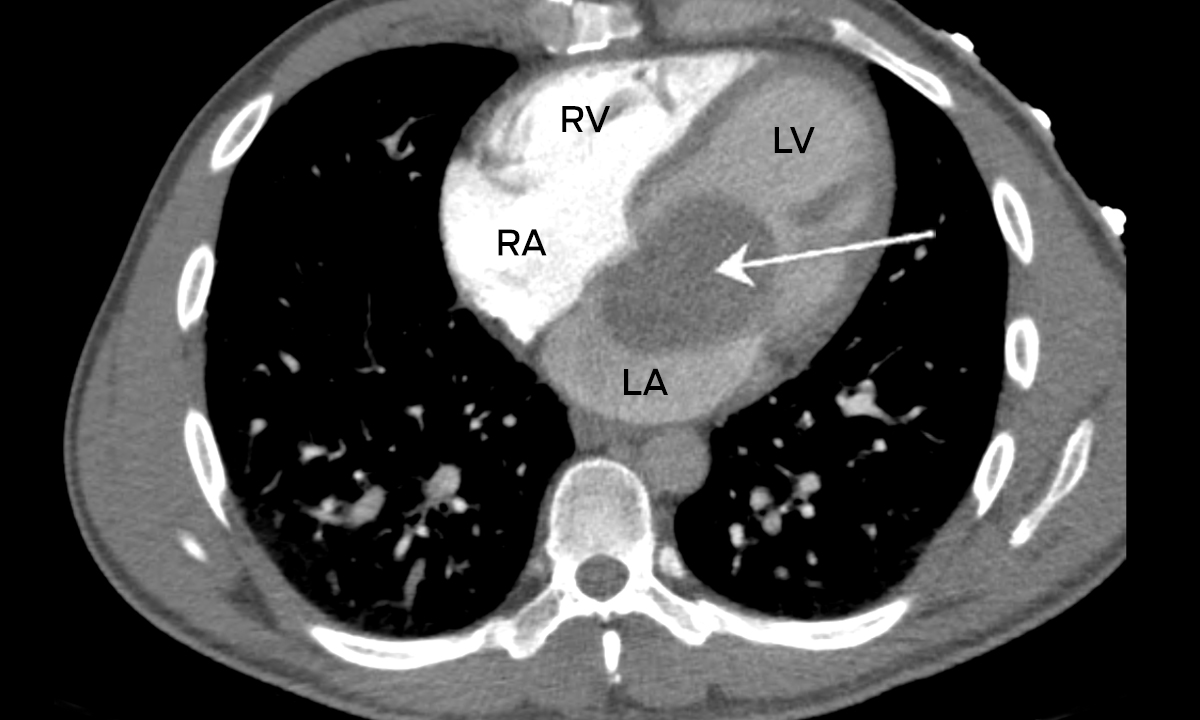 Expectorate the unexpected | The Medical Journal of Australia