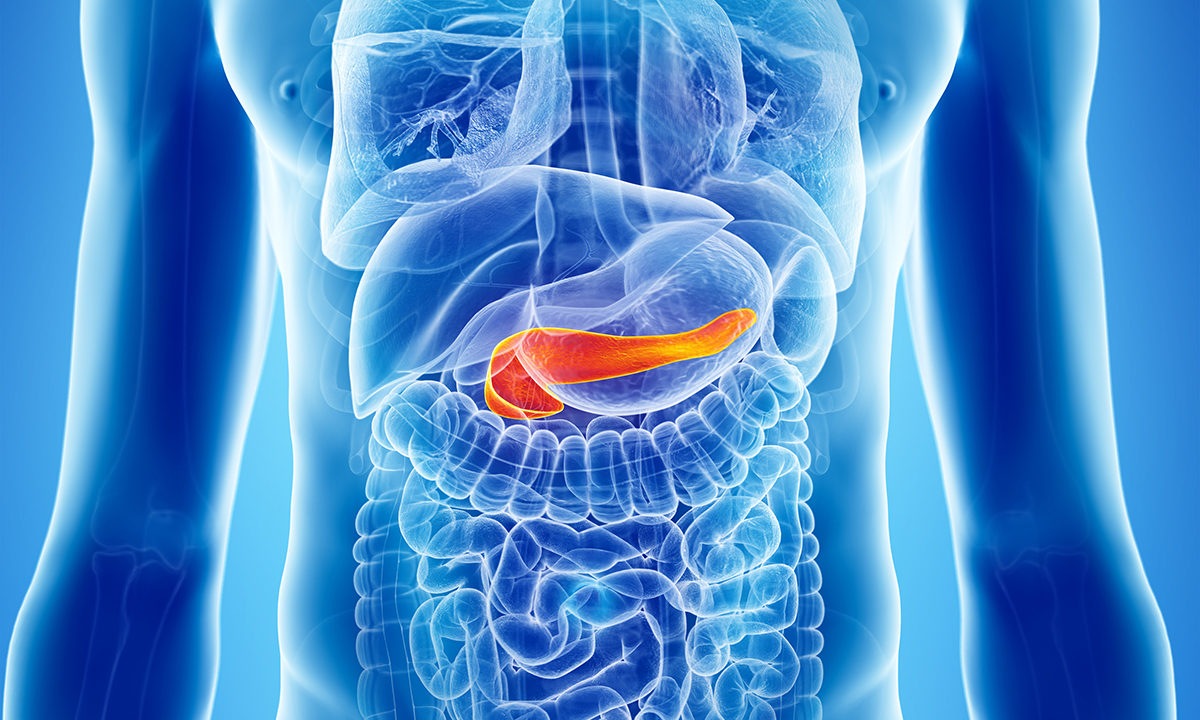Diagnosis and management of pancreatic exocrine insufficiency | The