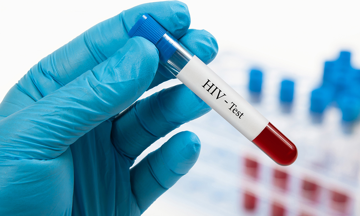 Reducing the gap between the diagnosis and treatment of HIV infection ...