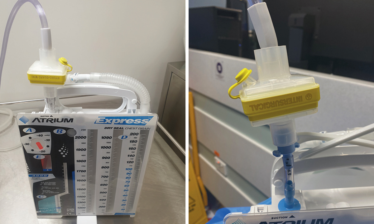 consensus-statement-safe-airway-society-principles-of-airway