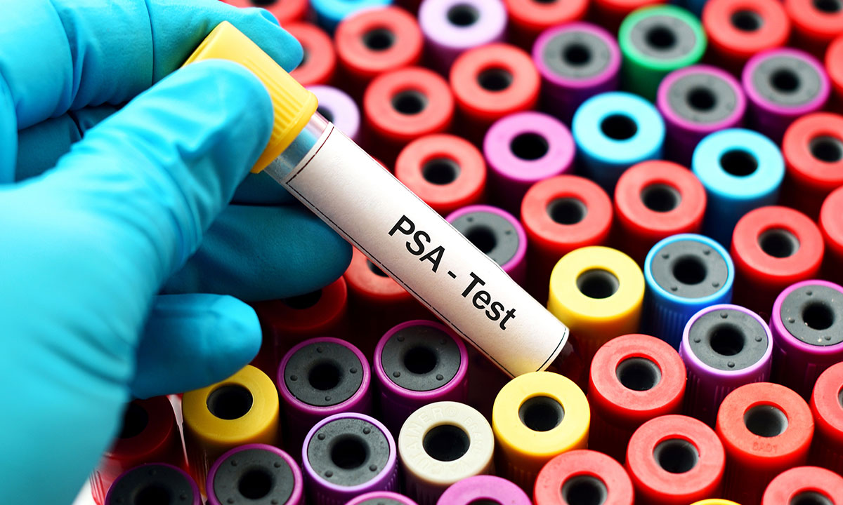 Excessive Psa Testing In General Practice 