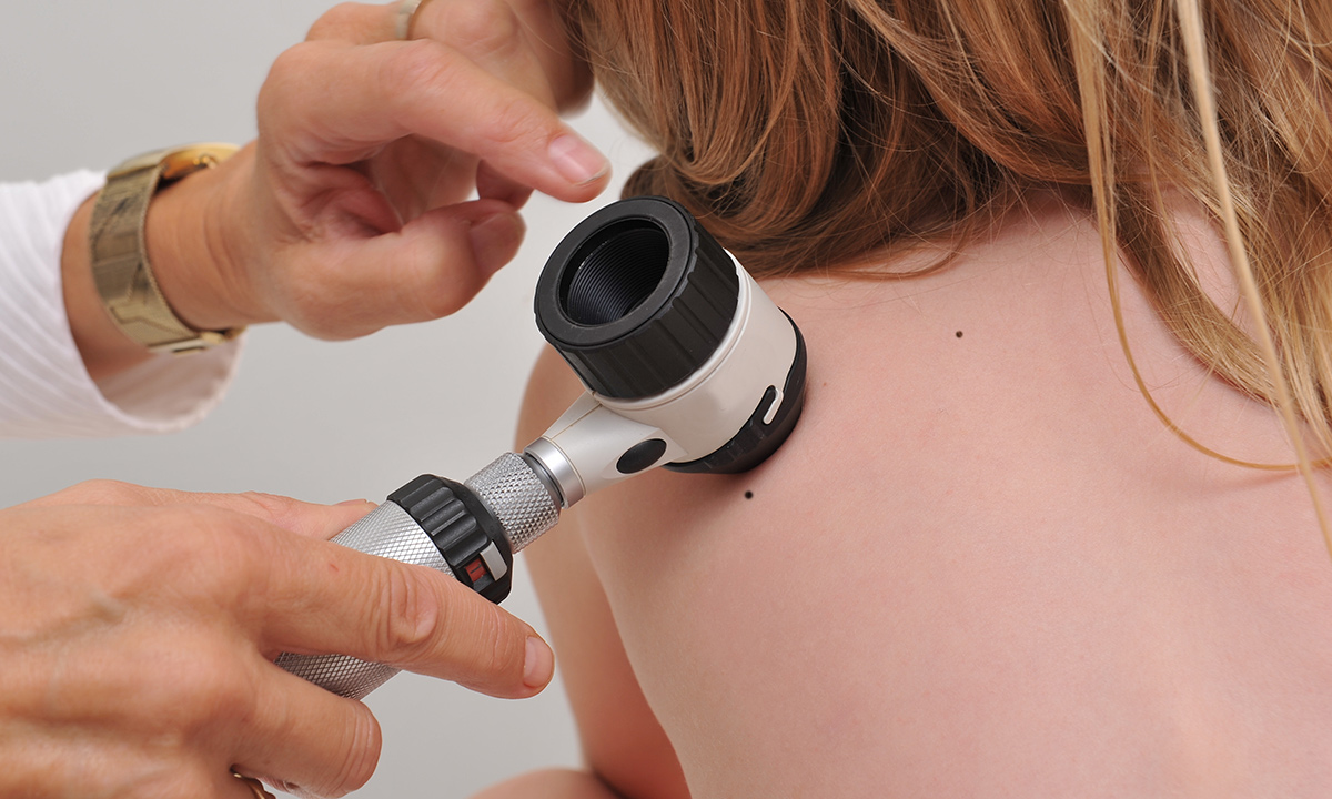 What is the reason for the decline in melanoma rates among young Australians?