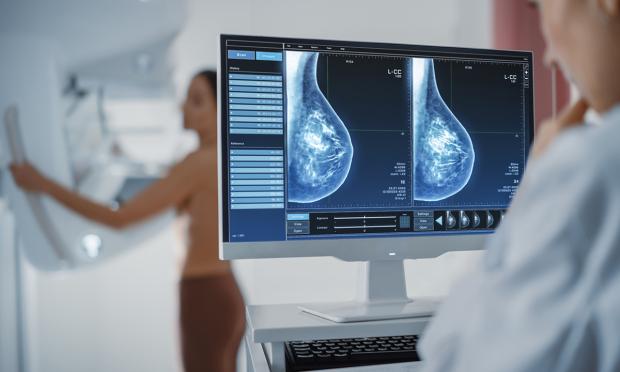 The impact of the BreastScreen NSW transition from film to digital mammography, 2002–2016: a linked population hea