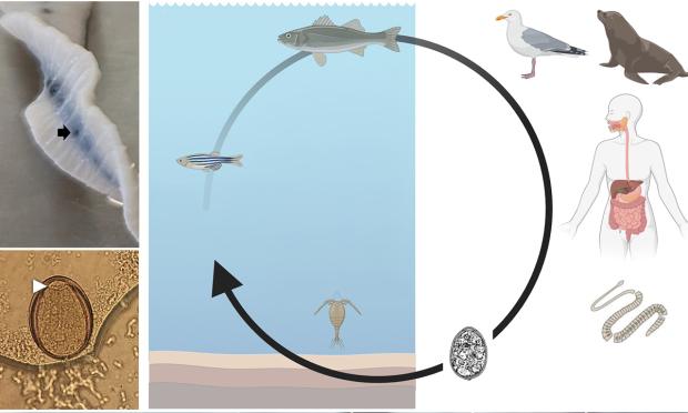 Human case of diphyllobothriasis in Australia